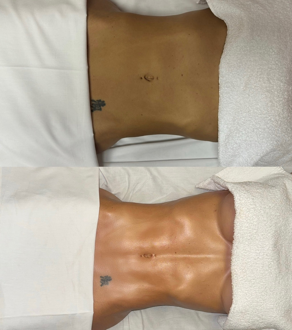 The Lymph Addicts Online Community
