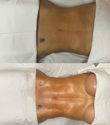 Lymphatic Organic session