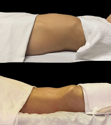 Lymphatic Organic session